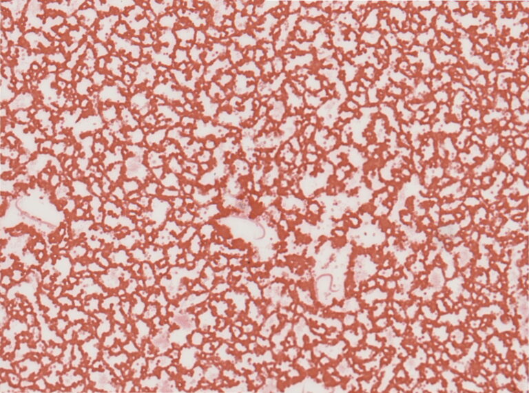 Dirofilaria immitis