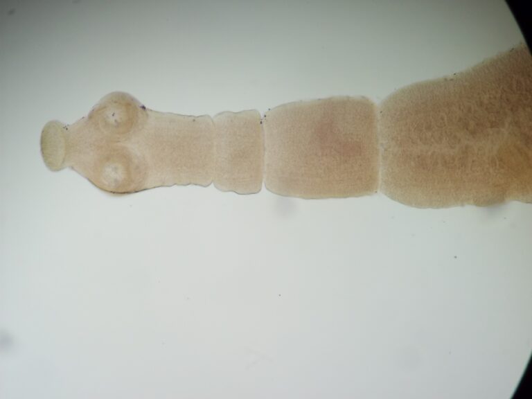 Echinococcus granulosus