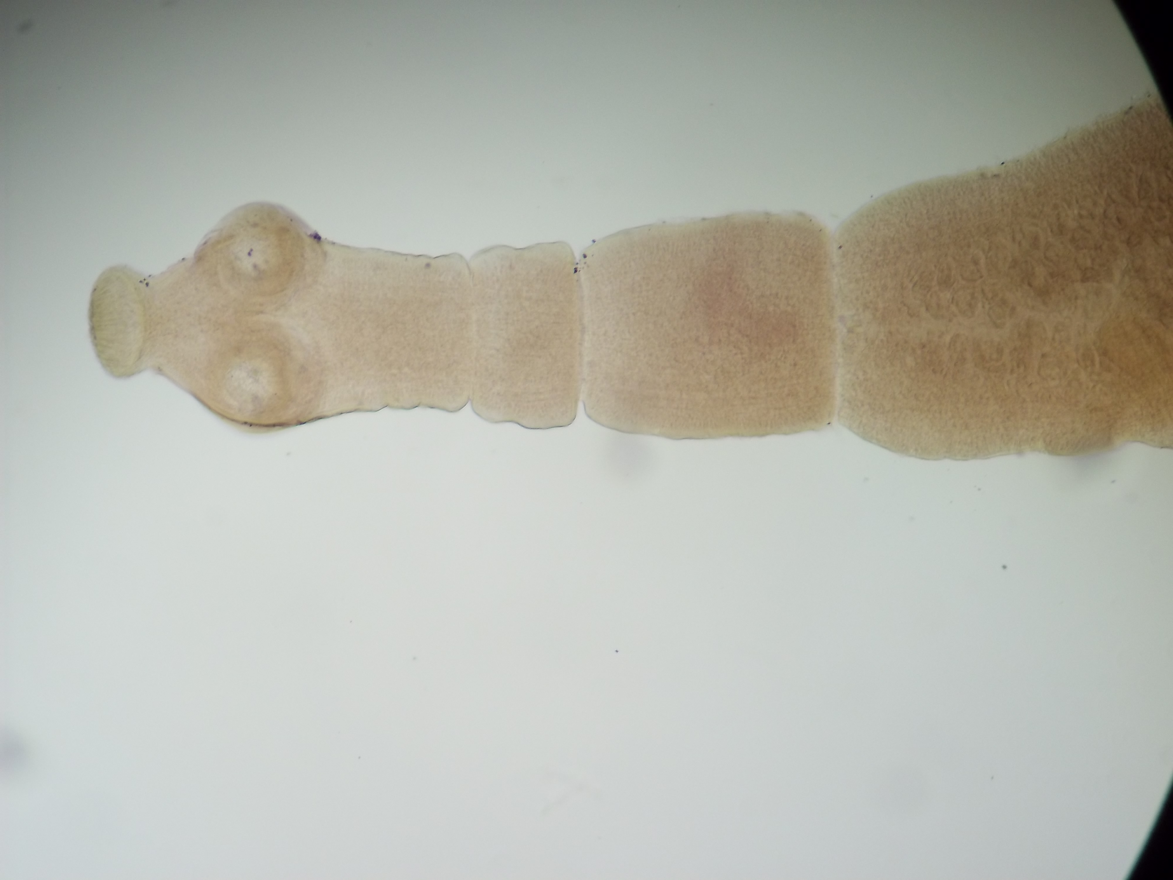 Echinococcus granulosus
