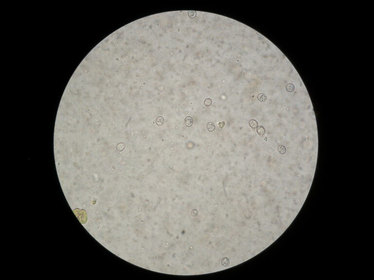 Eimeria bovis