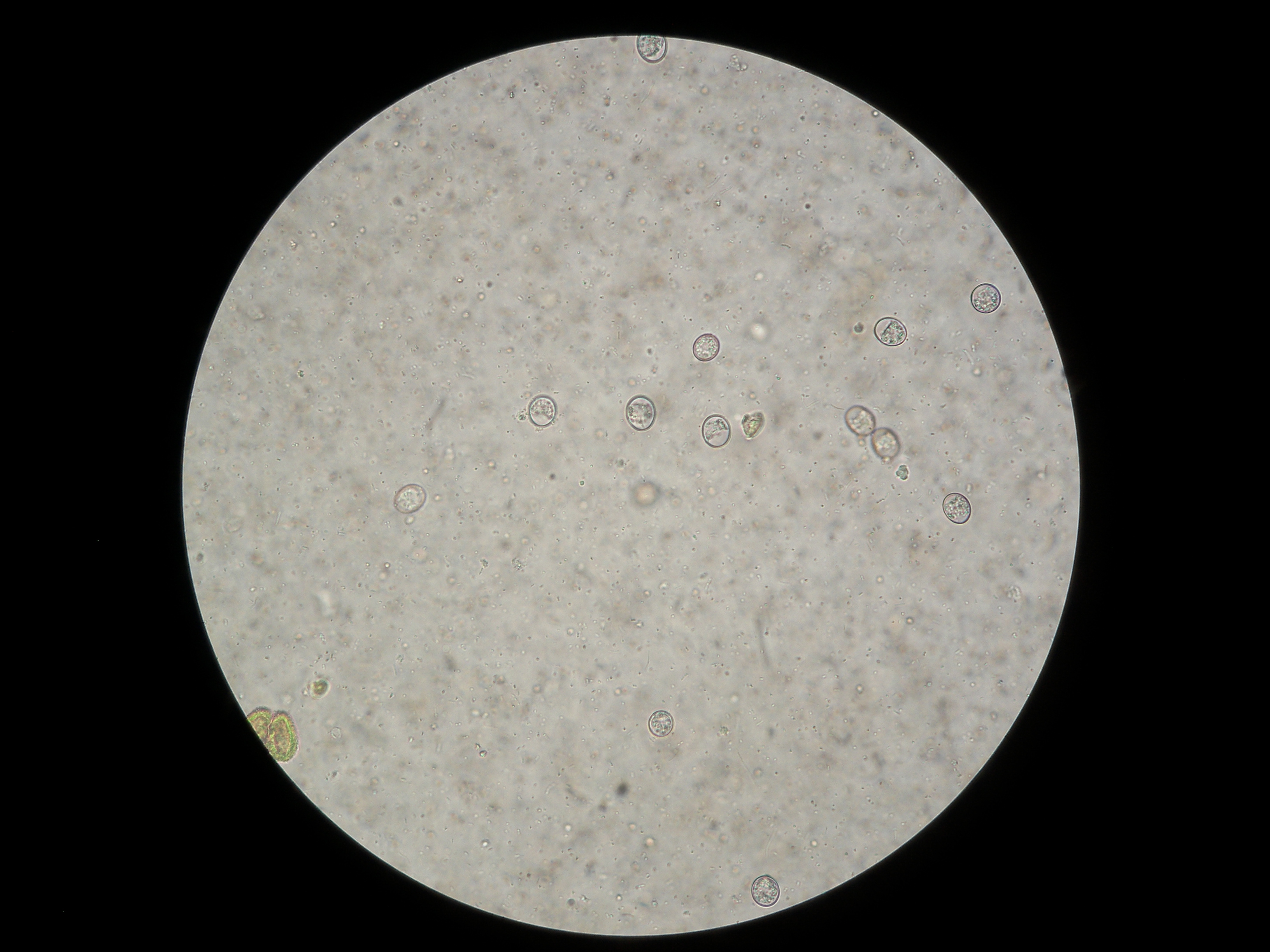 Eimeria bovis