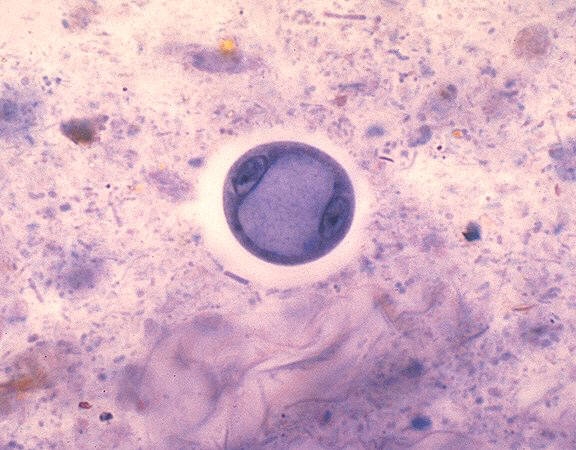 Entamoeba coli