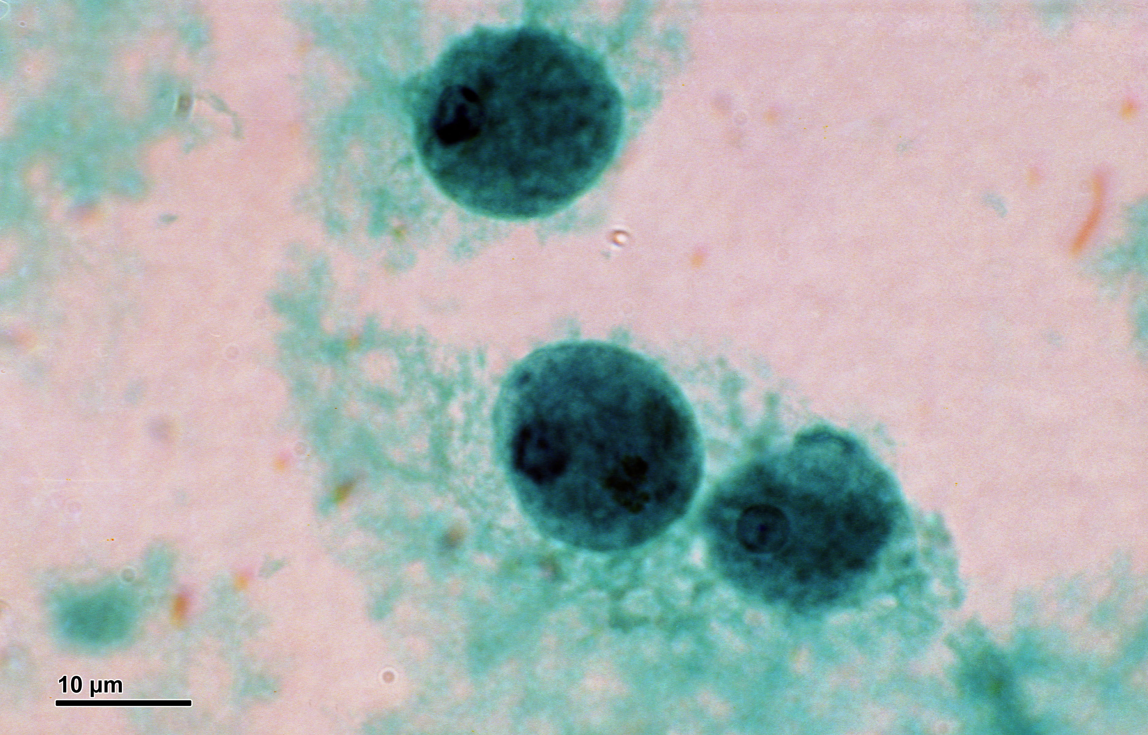 Entamoeba histolytica