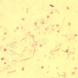 Enterocytozoon bieneusi