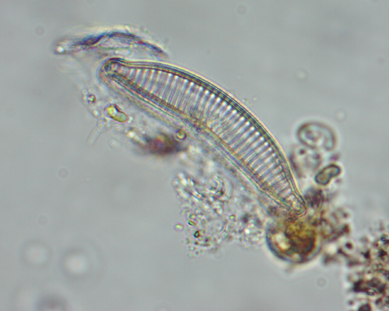 Epithemia turgida