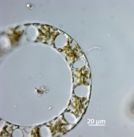 Eucampia zodiacus