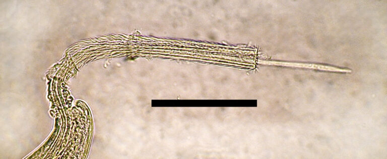 Eucoleus aerophilus