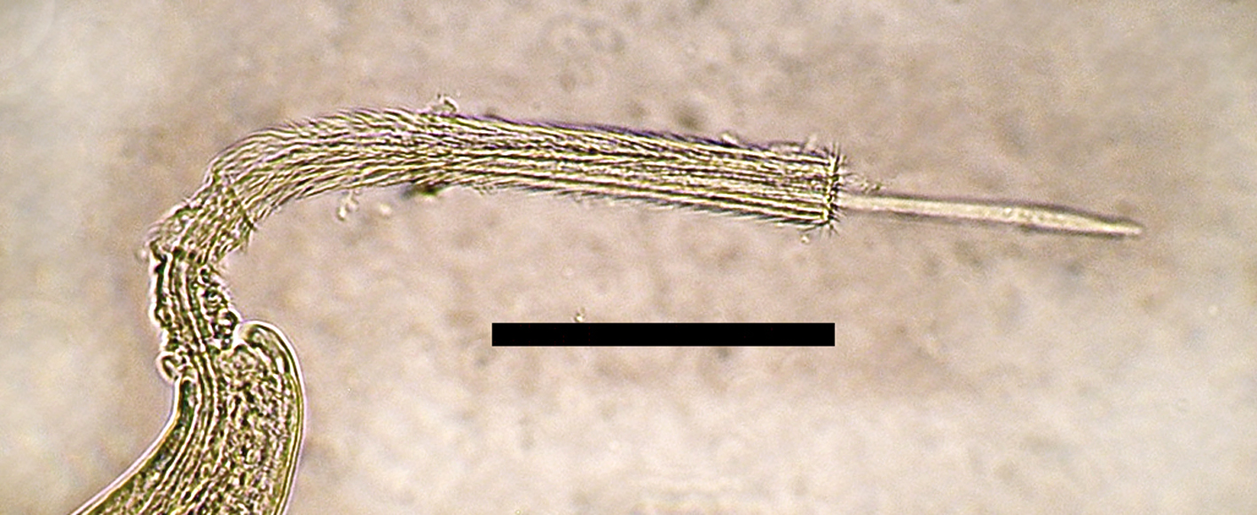 Eucoleus aerophilus