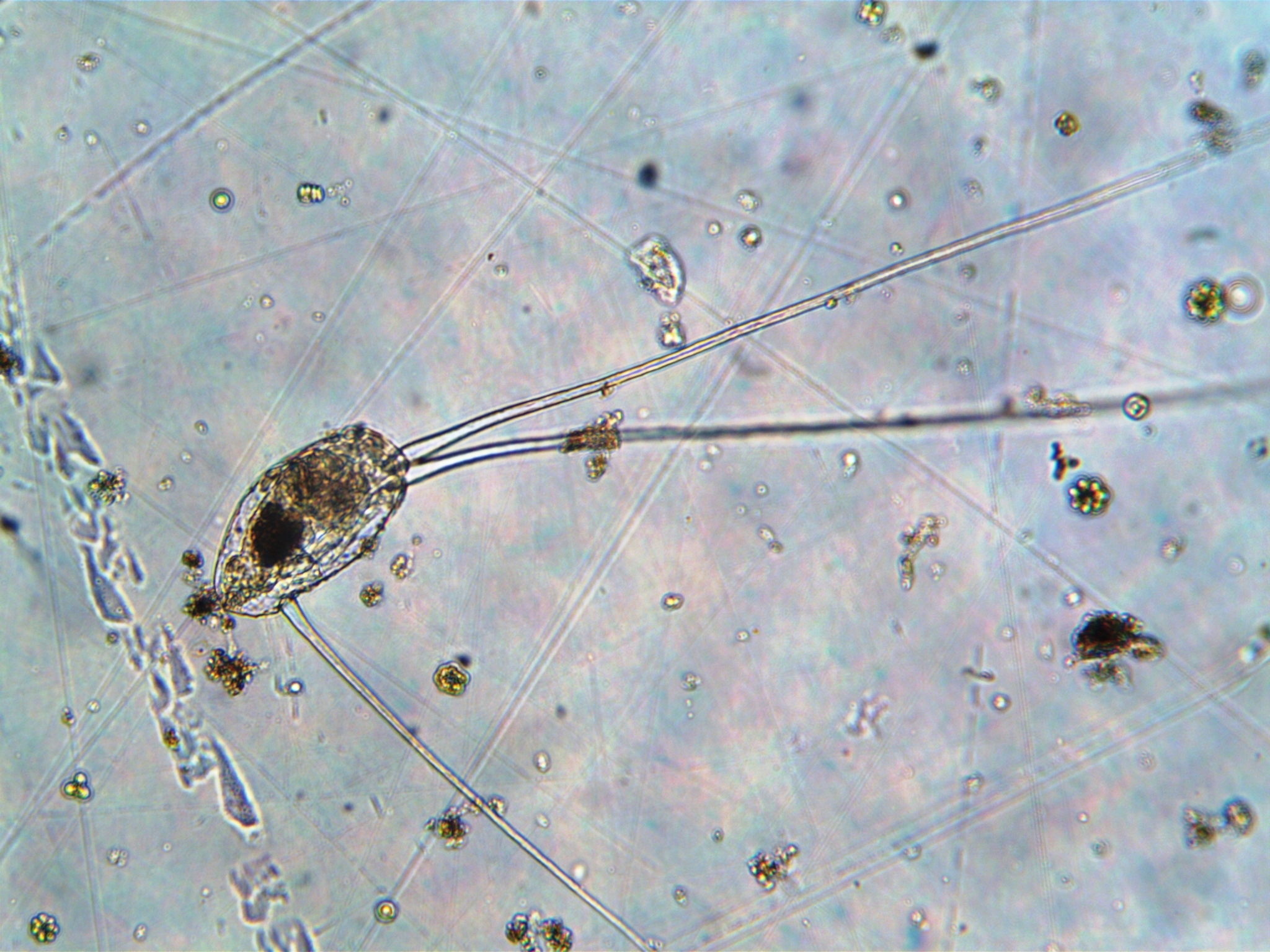 Filinia longiseta
