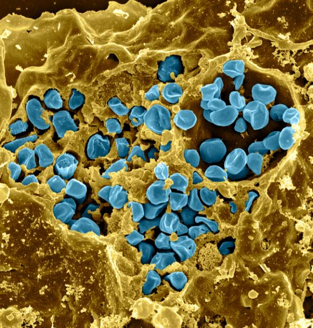Francisella tularensis Francisella tularensis