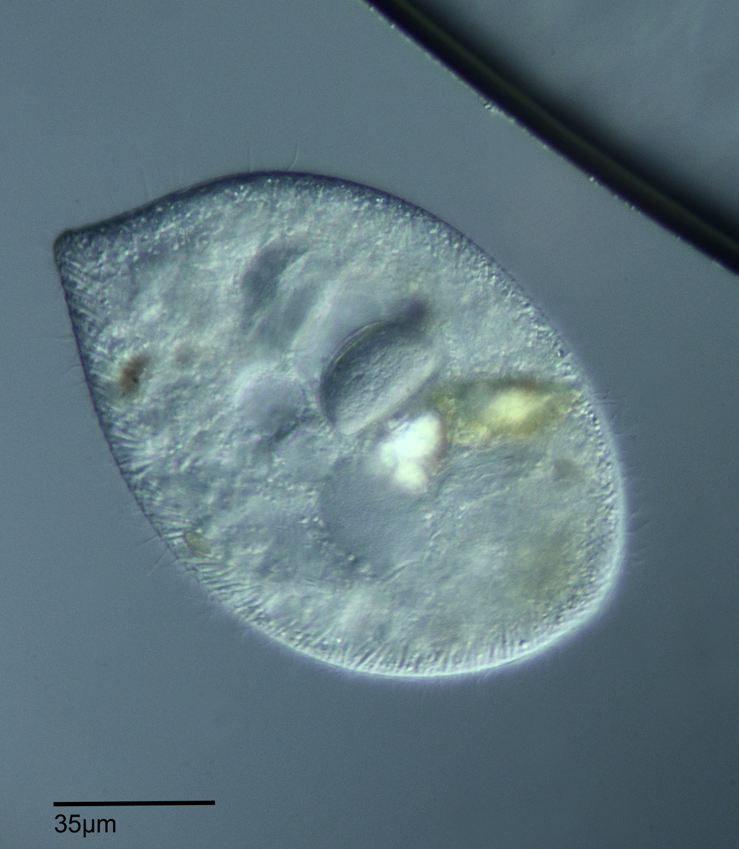 Frontonia atra