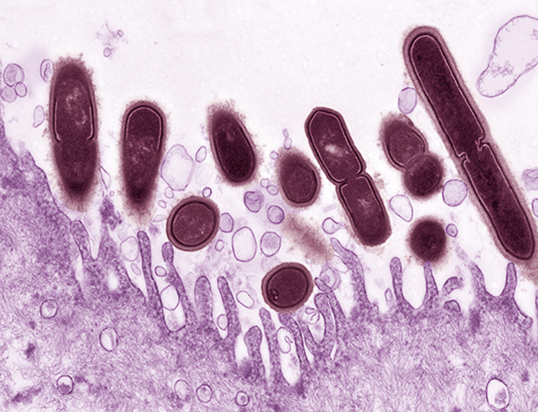 Gardnerella vaginalis