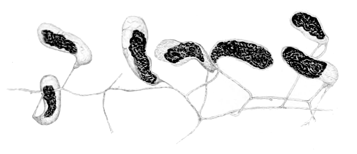 Geosiphon pyriformis