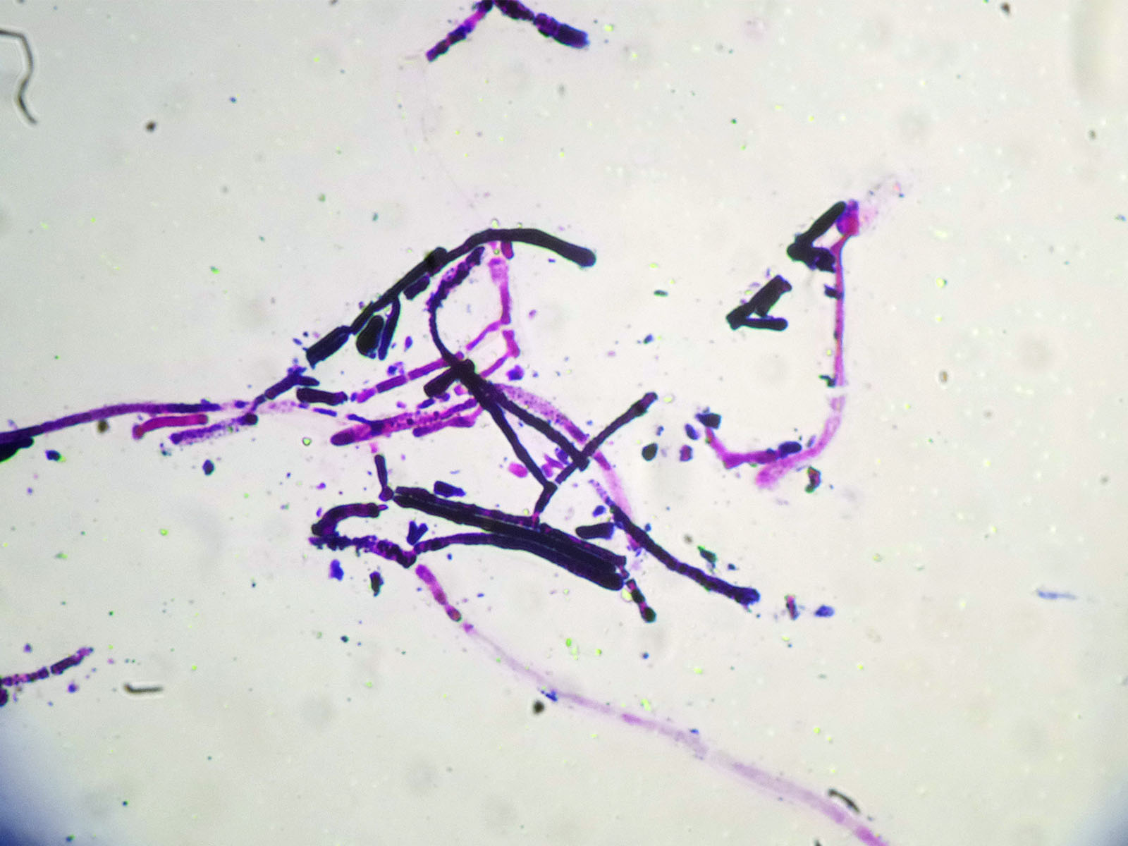 Geotrichum candidum