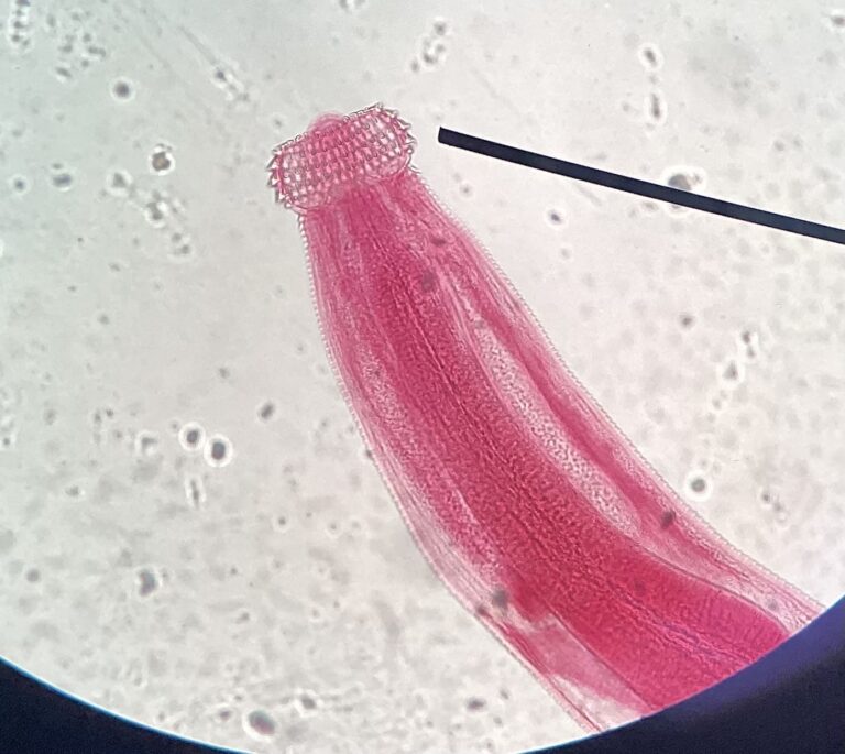 Gnathostoma spinigerum