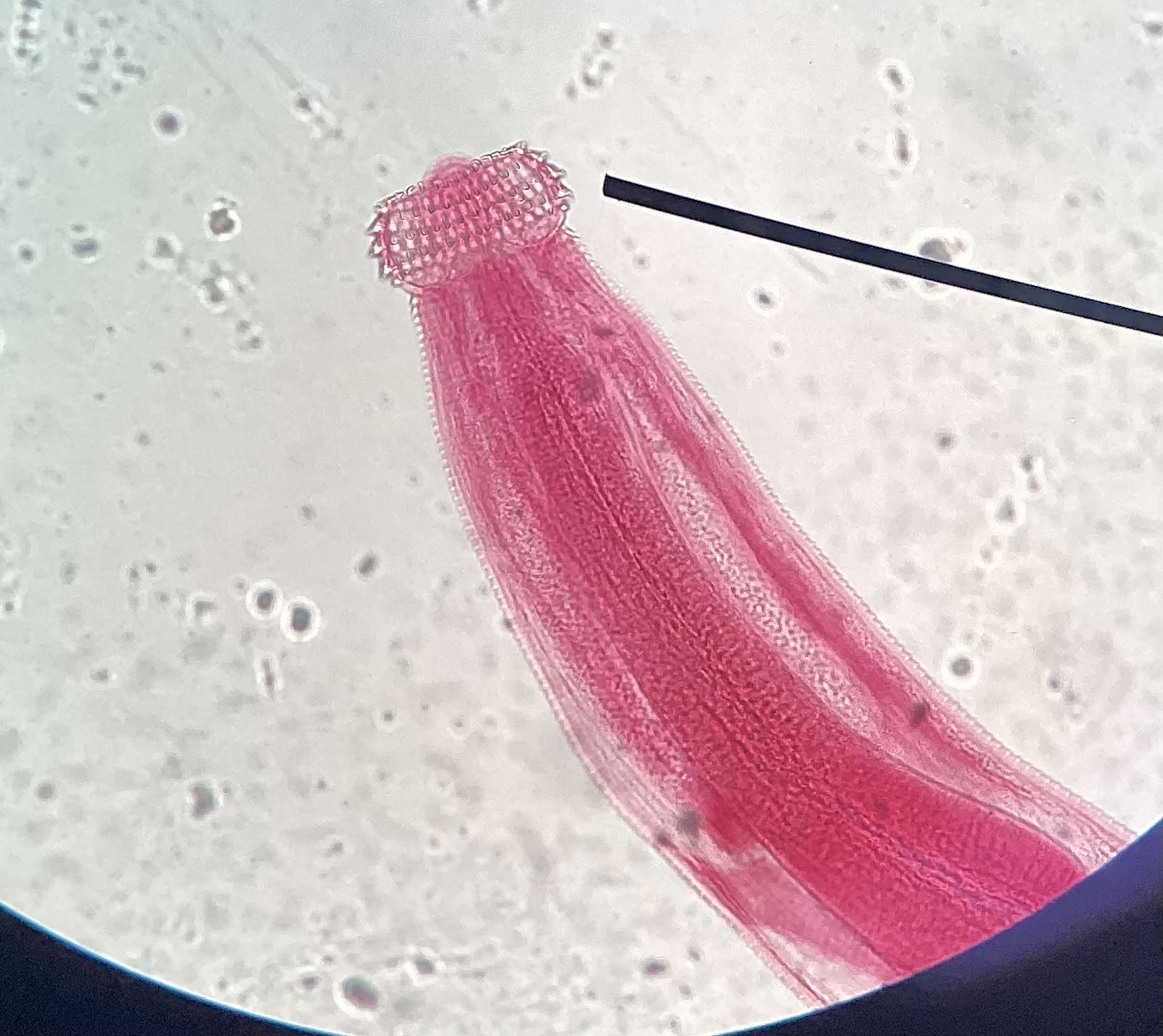 Gnathostoma spinigerum