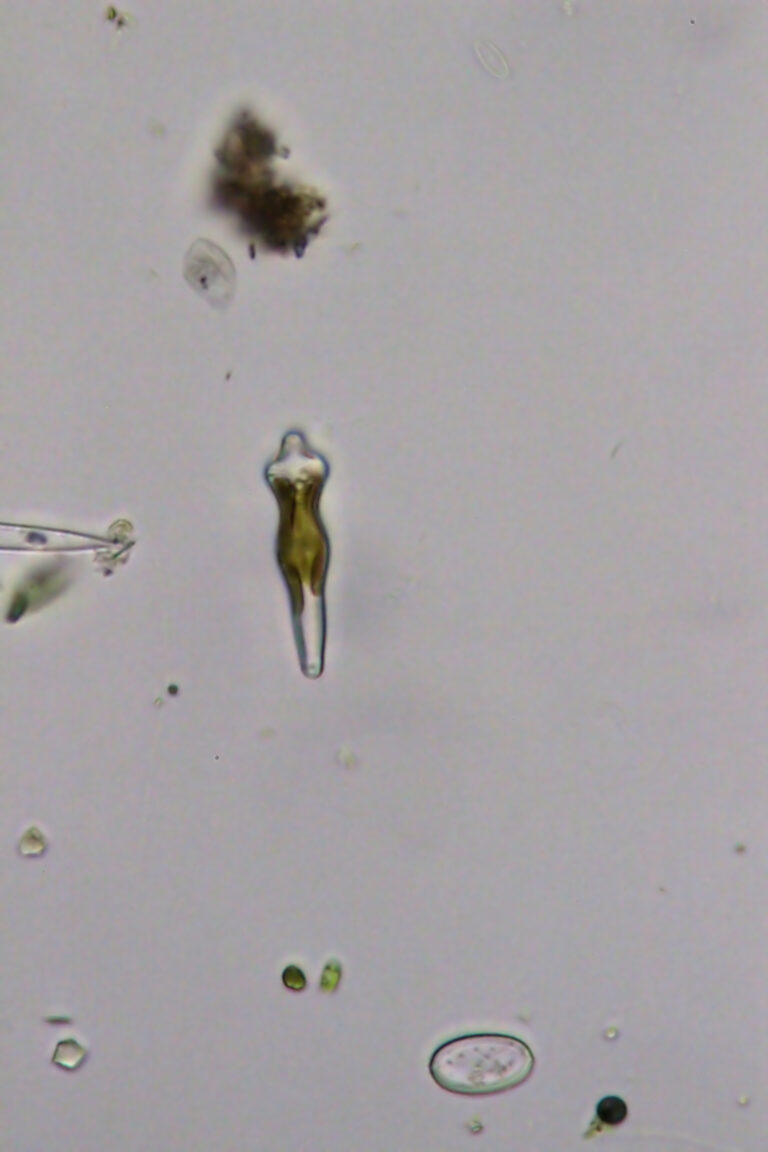 Gomphonema acuminatum Gomphonema acuminatum