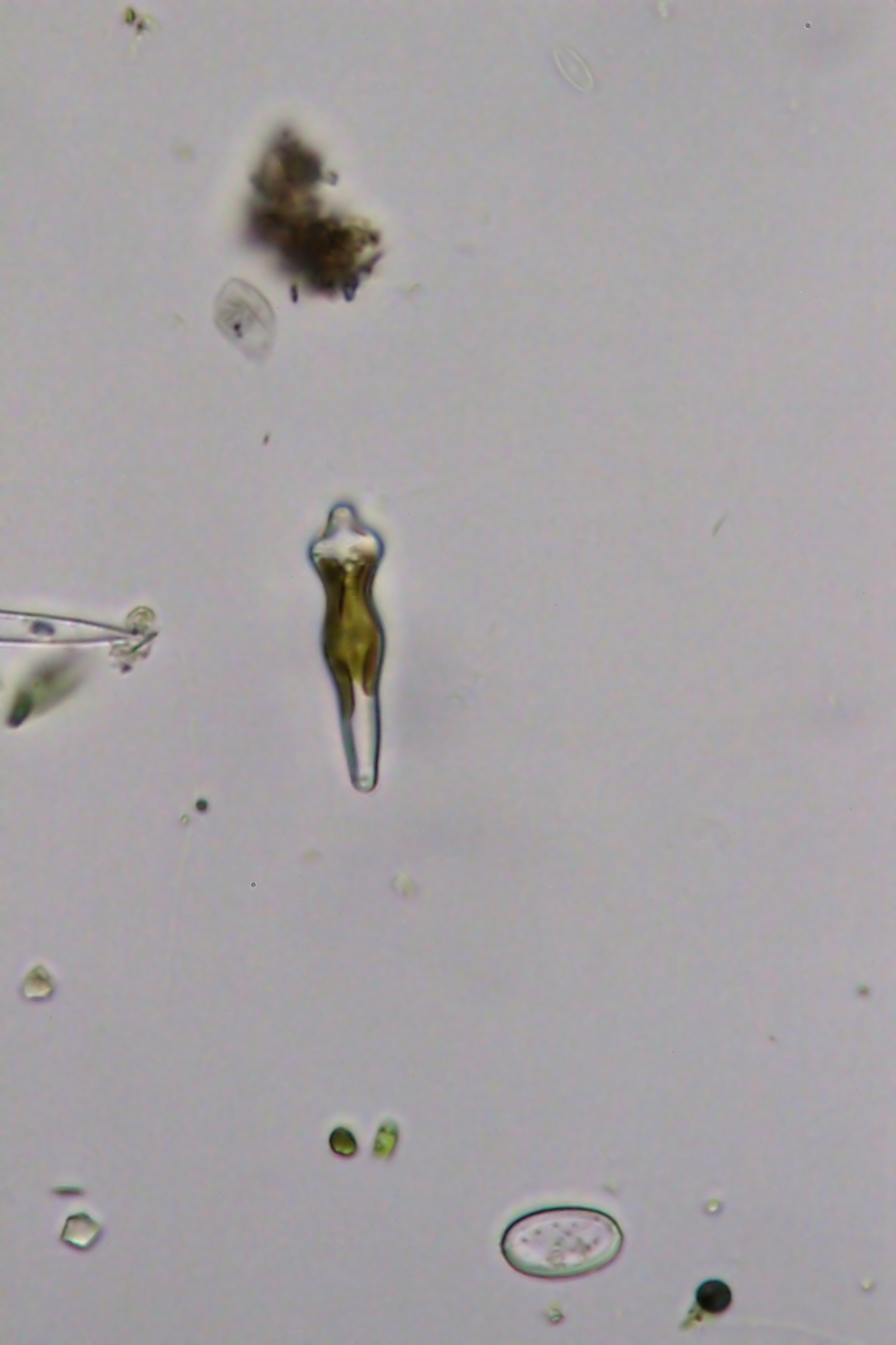 Gomphonema acuminatum