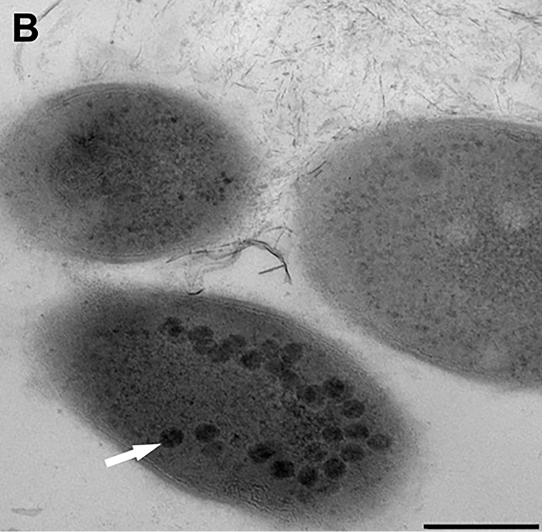 Gordonia terrae