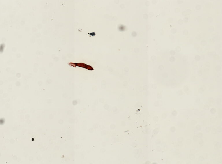 Gyrodactylus elegans