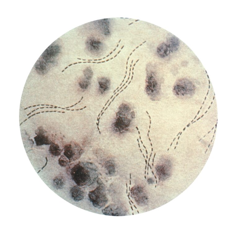 Haemophilus ducreyi (Haemophilus ducreyi)