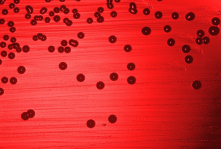 Haemophilus influenzae