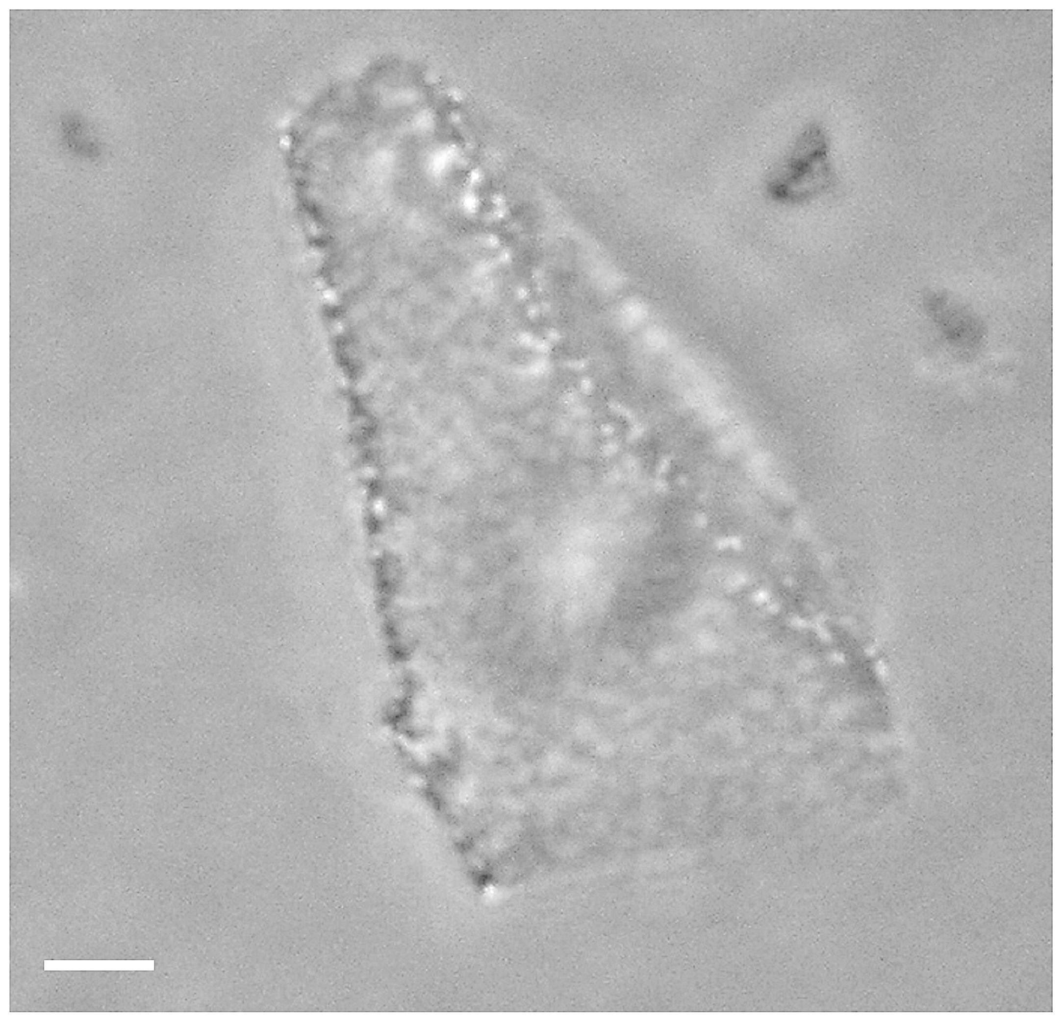 Haloquadratum walsbyi