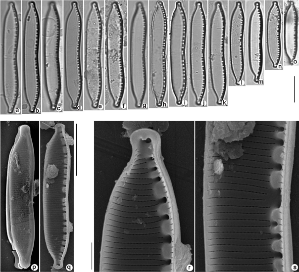 Hantzschia amphioxys