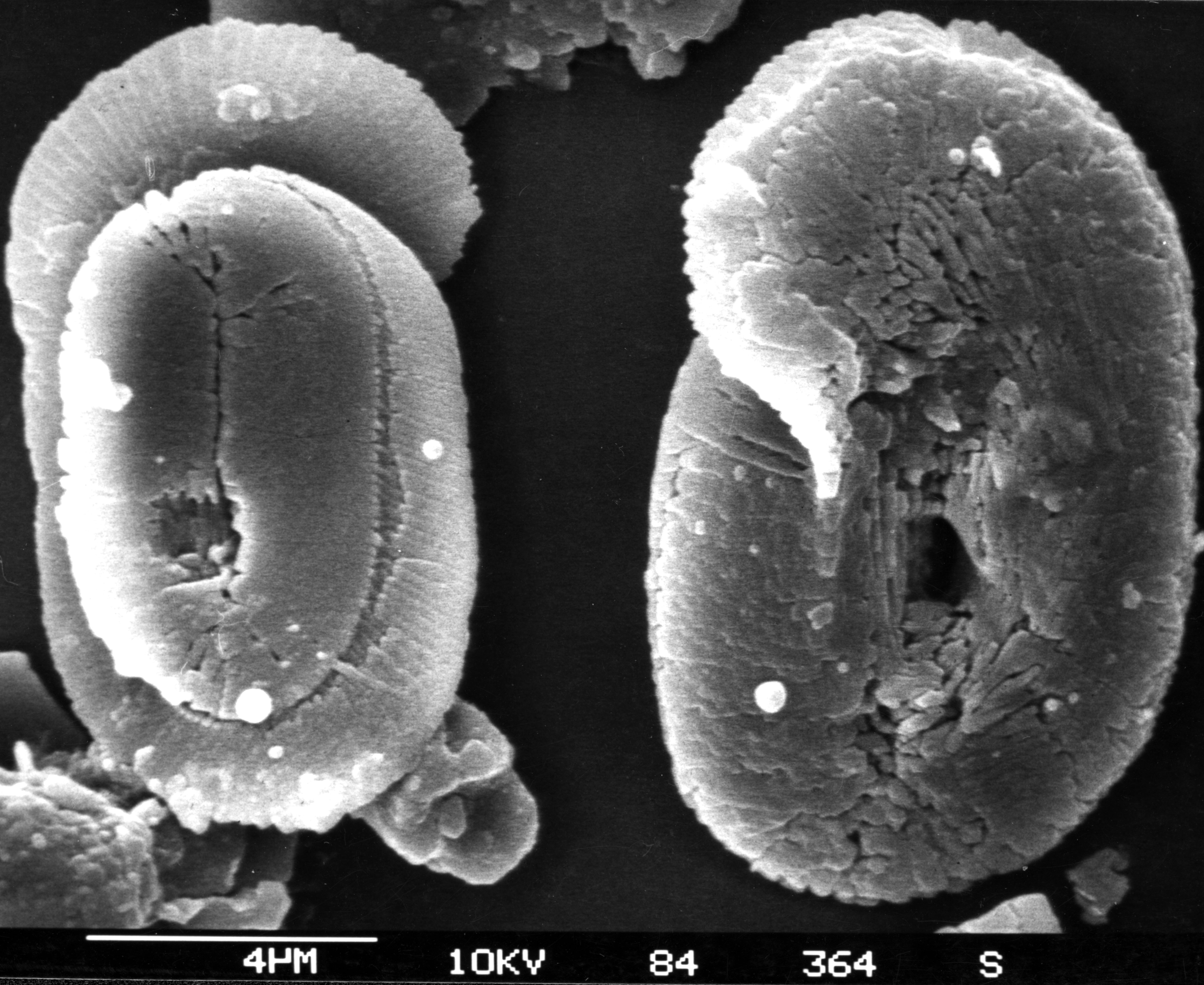 Helicosphaera carteri