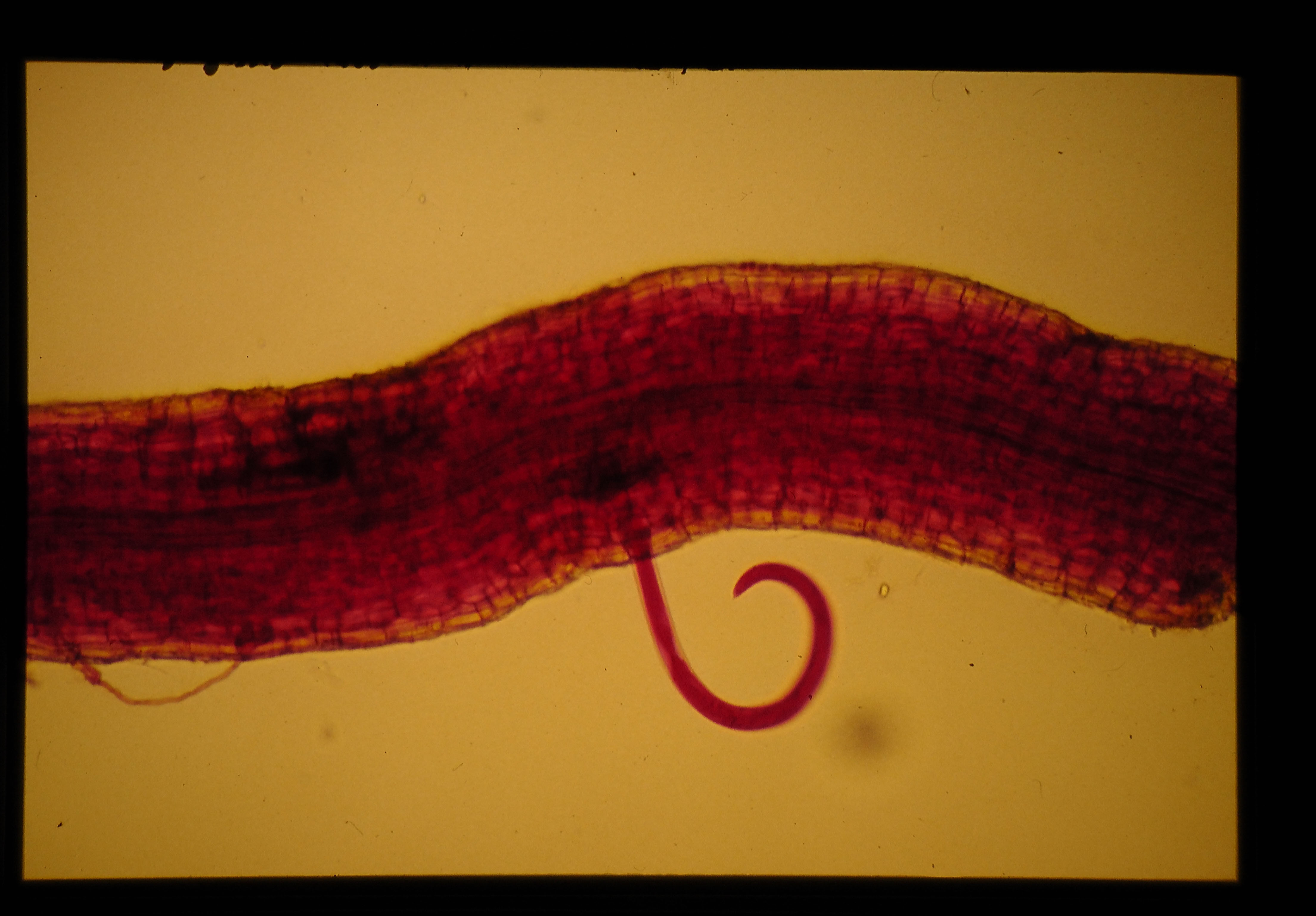 Helicotylenchus dihystera