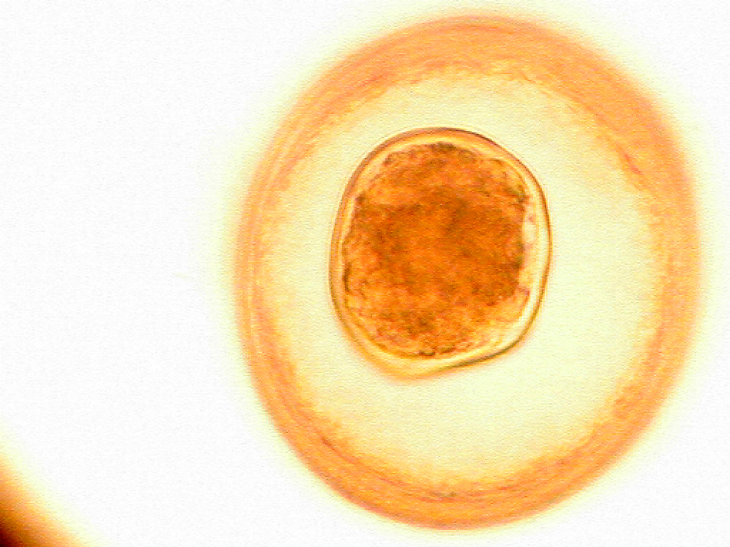 Hymenolepis diminuta