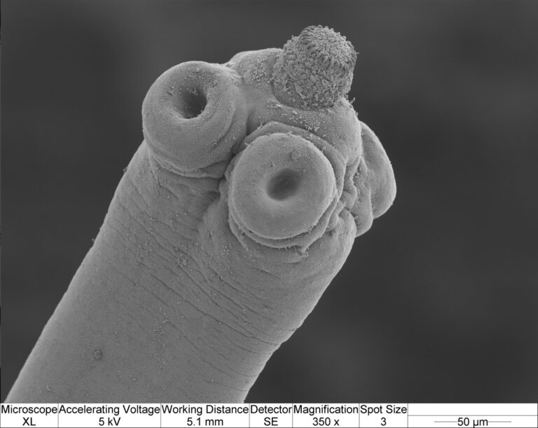 Hymenolepis microstoma Hymenolepis microstoma