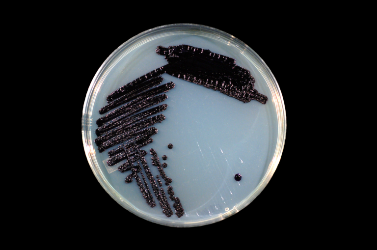 Janthinobacterium lividum