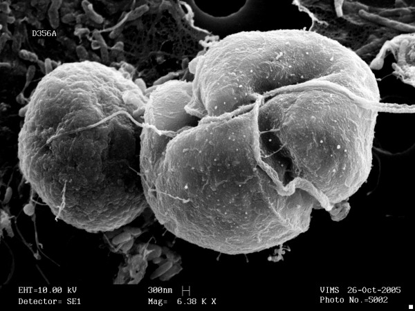 Karlodinium veneficum