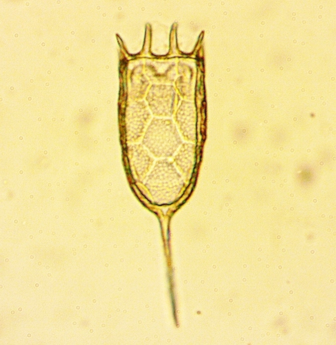 Keratella americana