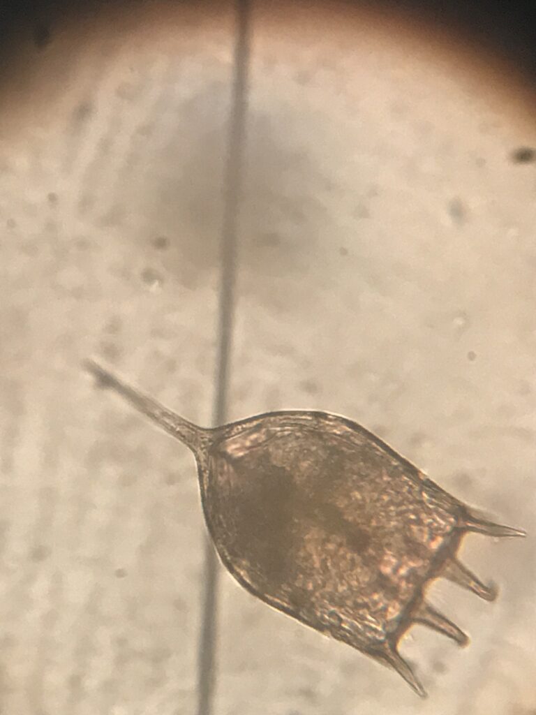 Keratella cochlearis