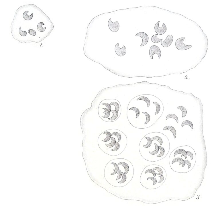 Kirchneriella lunaris Kirchneriella lunaris