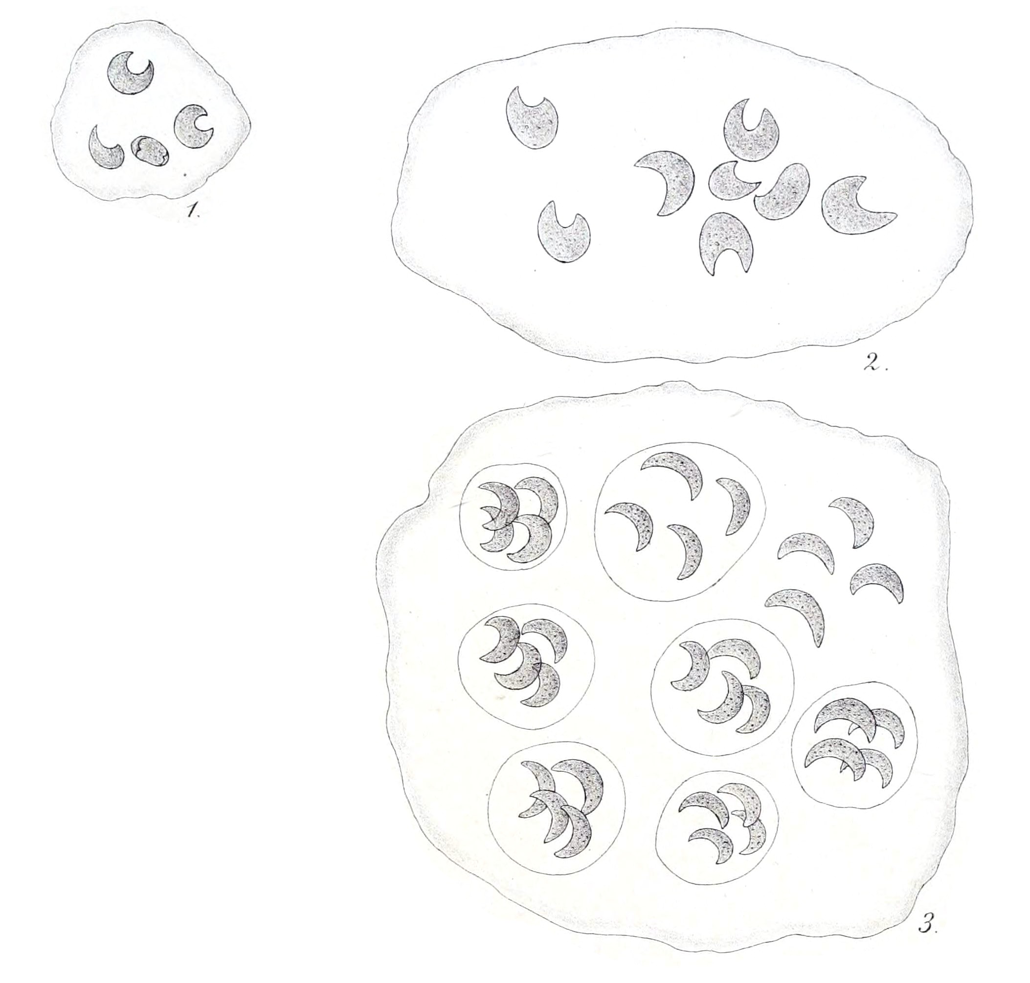 Kirchneriella lunaris