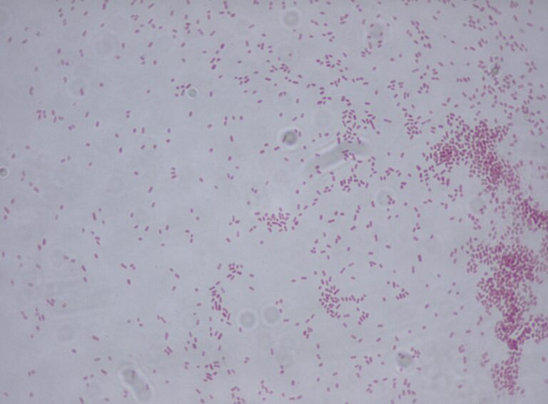 Klebsiella aerogenes