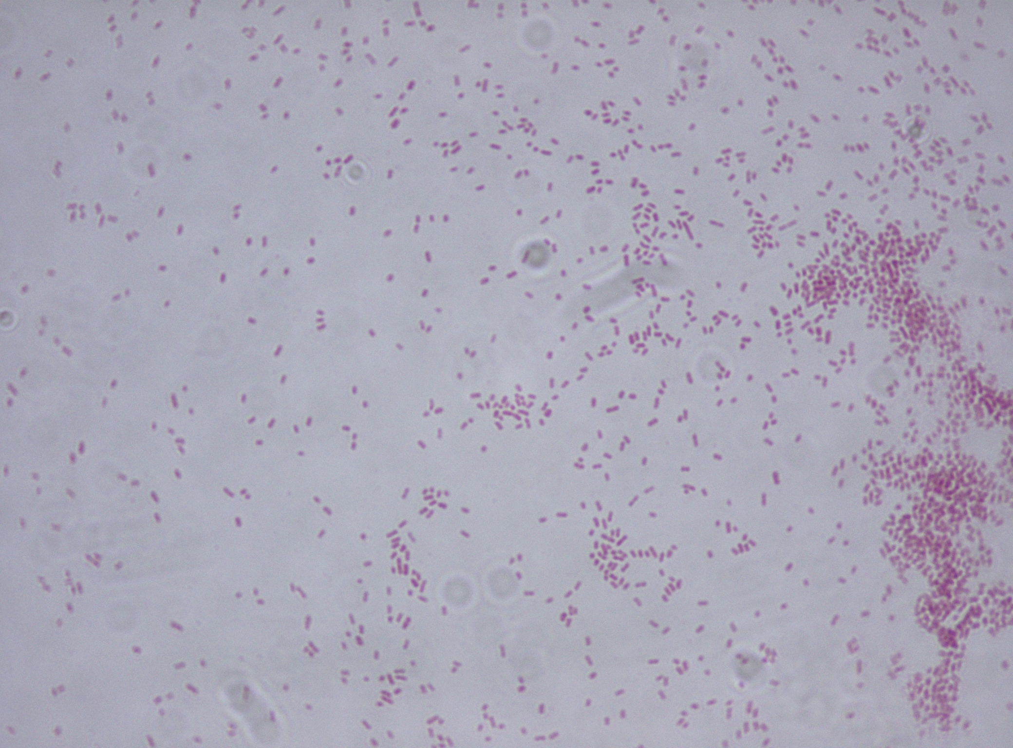 Klebsiella aerogenes
