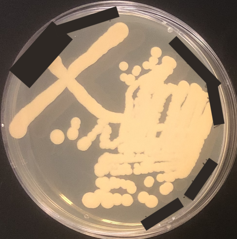 Kluyveromyces lactis