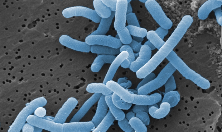 Lacticaseibacillus paracasei