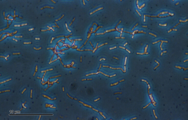 Lactobacillus acidophilus