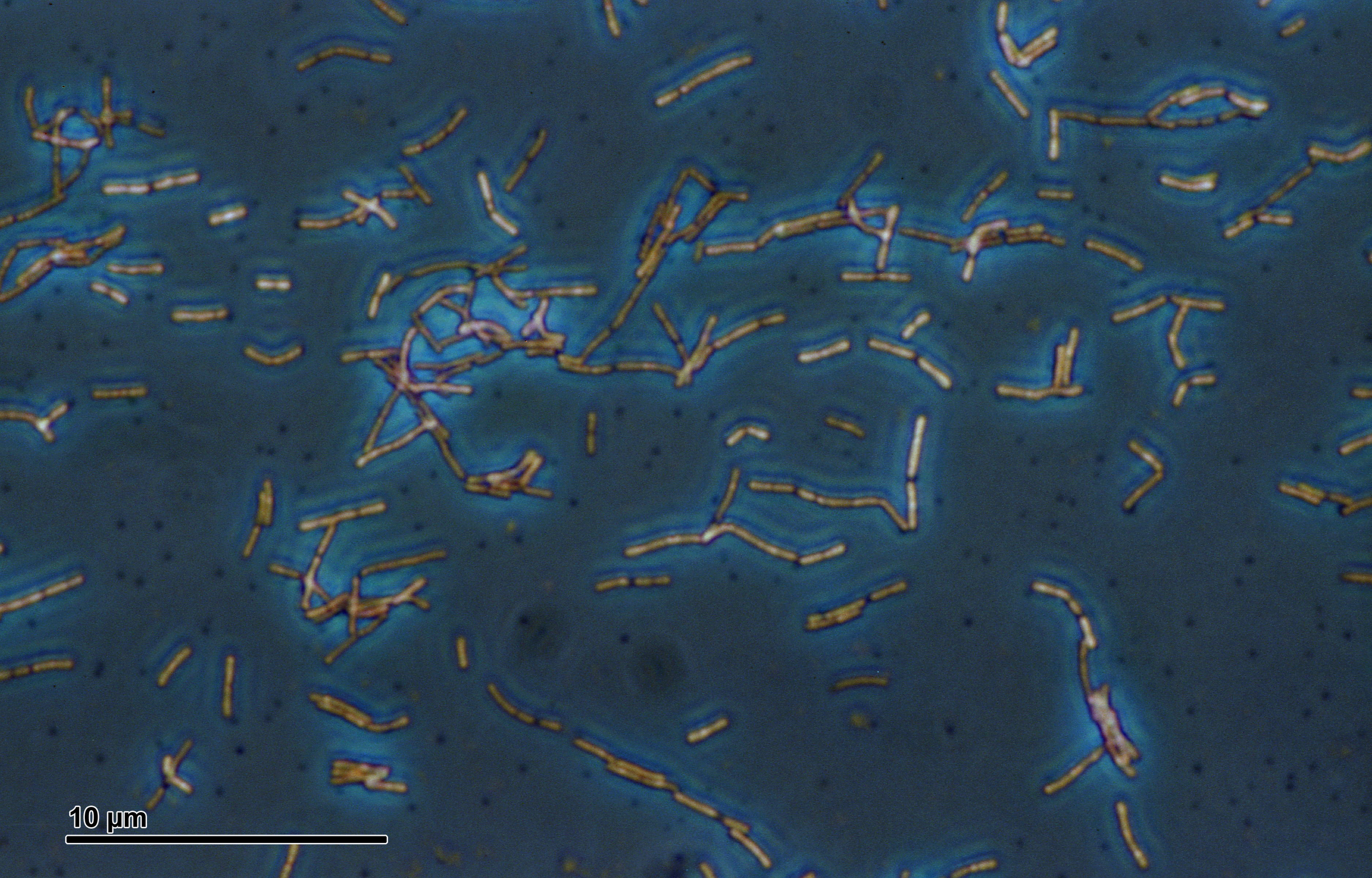 Lactobacillus acidophilus