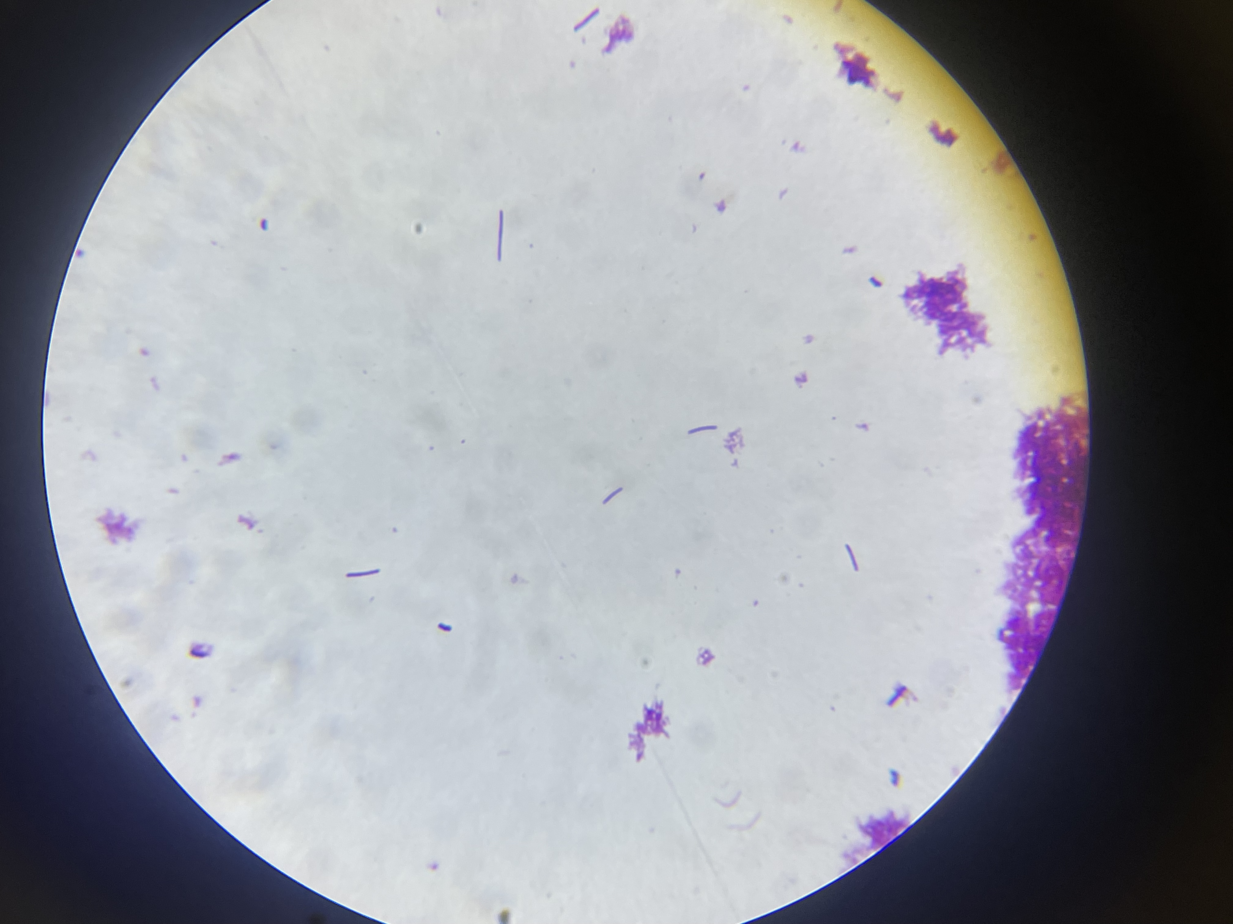 Lactobacillus delbrueckii