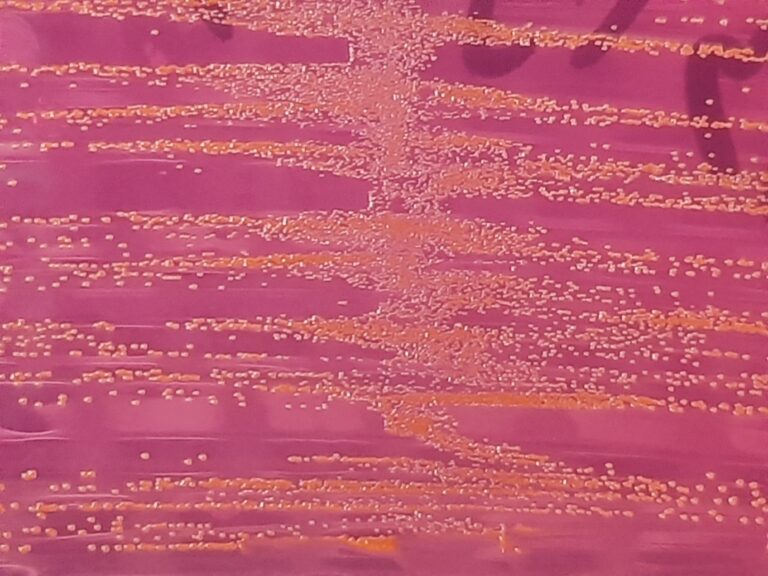 Lactococcus garvieae