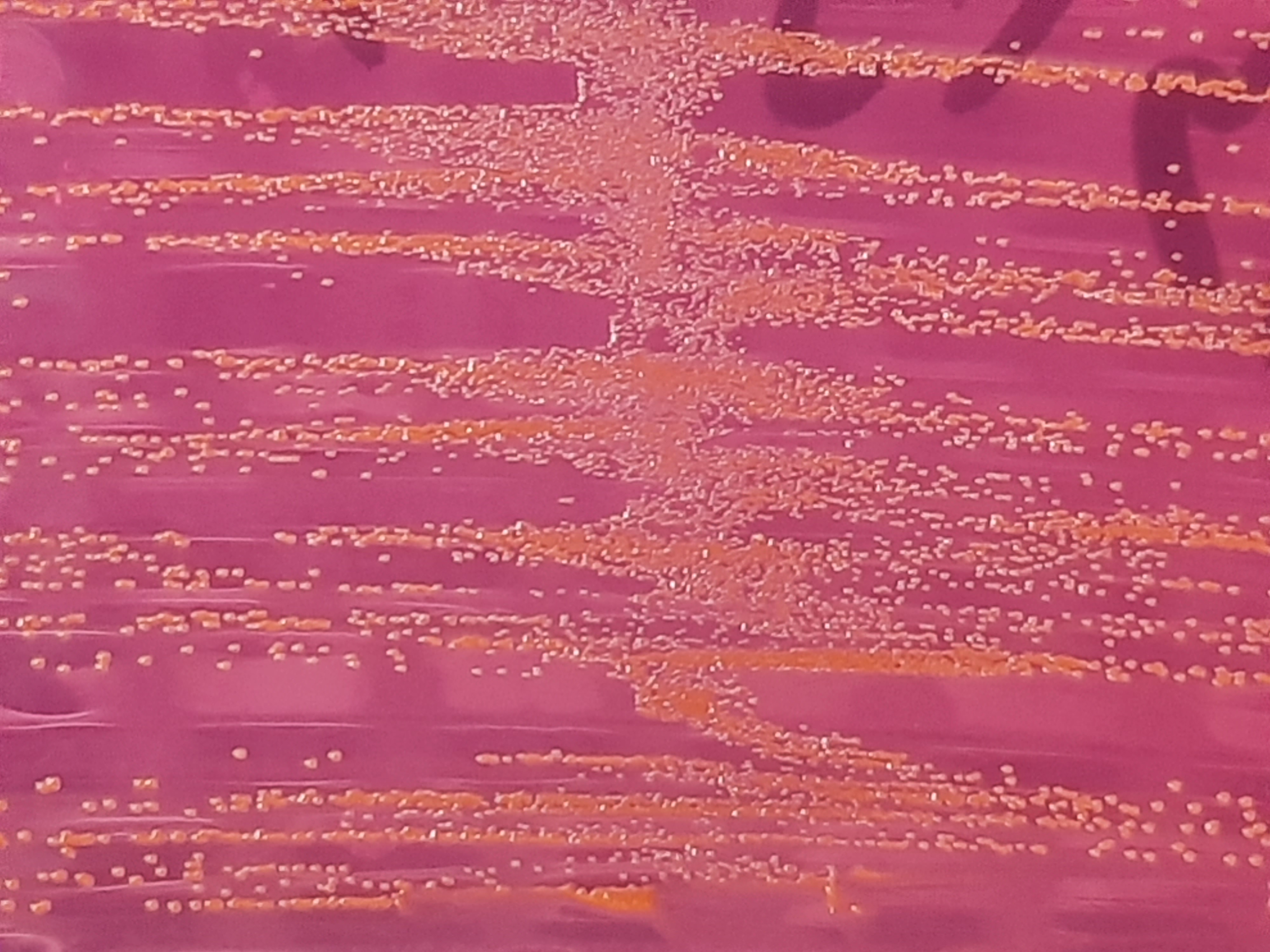 Lactococcus garvieae