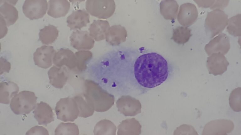 Leishmania donovani