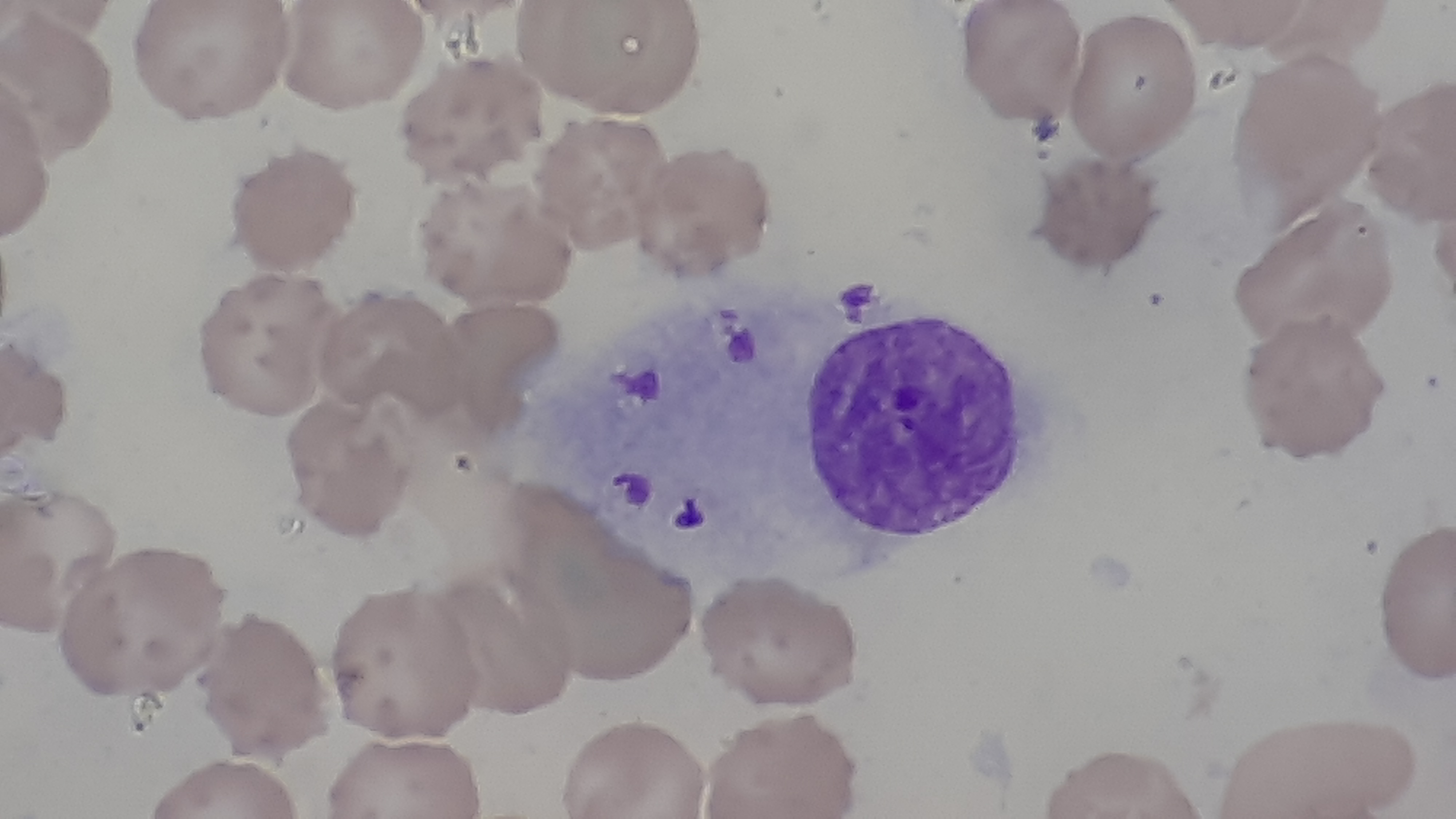 Leishmania donovani