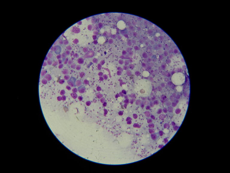 Leishmania infantum